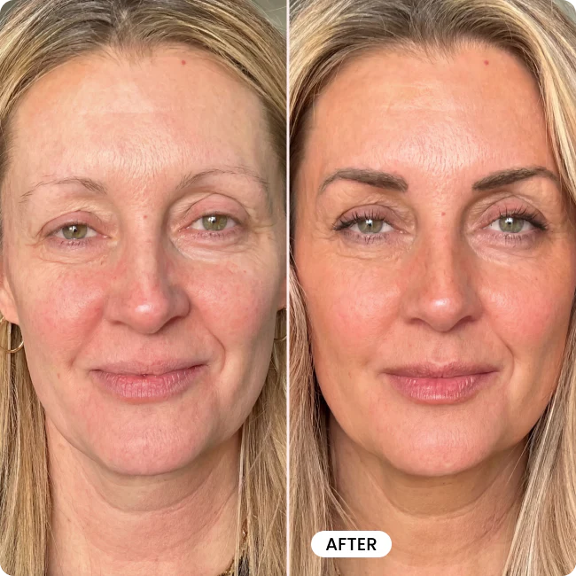 Bello Eyebrow Serum BOGO - Image 8