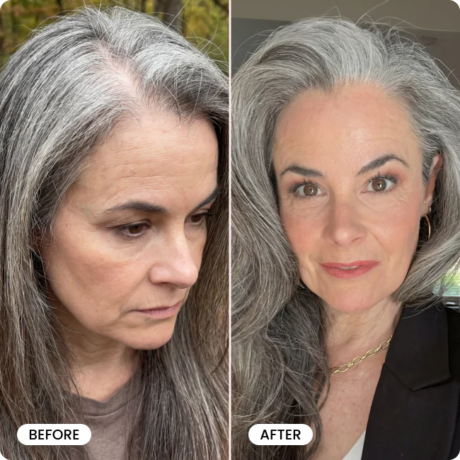 Bello Hair Booster Capsules - Image 6