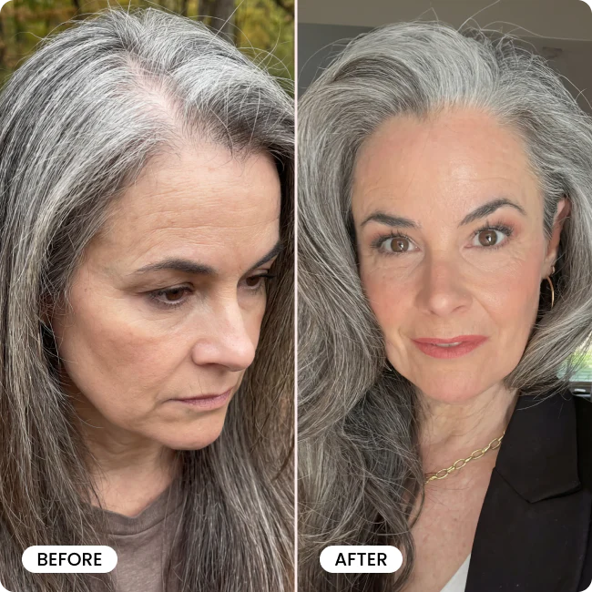 Bello Hair Booster Capsules BOGO - Image 7