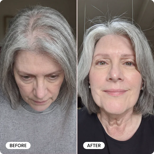 Bello Hair Booster Capsules BOGO - Image 8