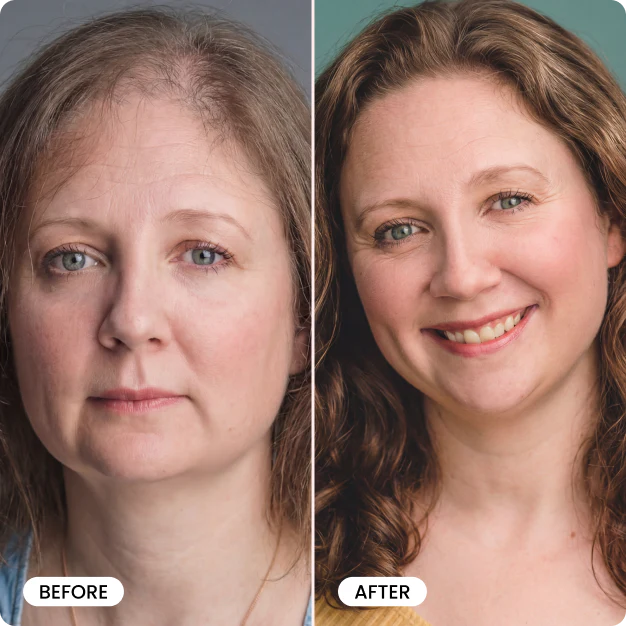Bello Hair Growth Conditioner BOGO - Image 8