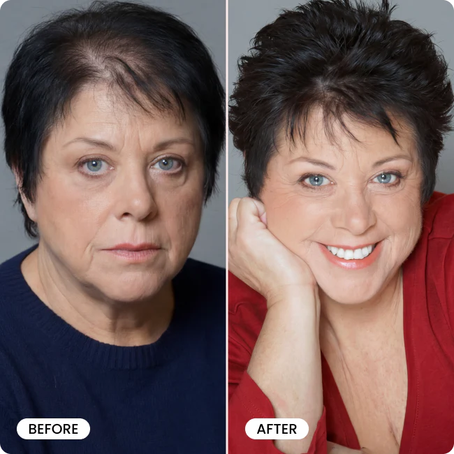 TryBello Hair Growth Conditioner - Image 6