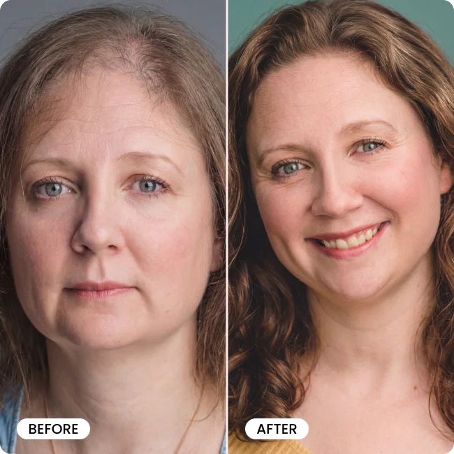 TryBello Hair Growth Conditioner - Image 7