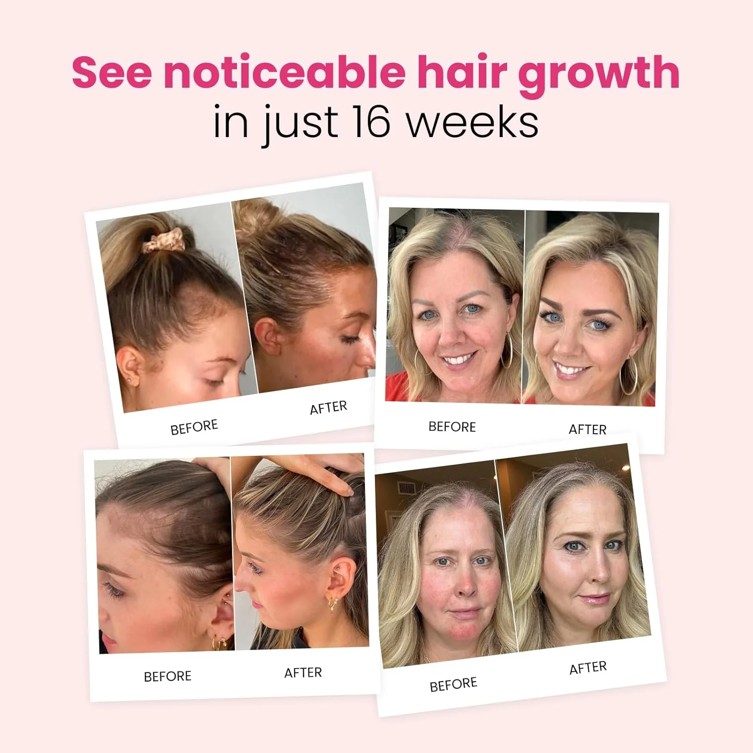 trybello Hair Growth Shampoo - Image 6